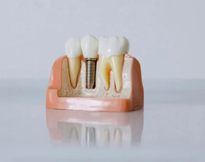 Why-Bone-Health-Matters-Before-Getting-Dental-Implants
