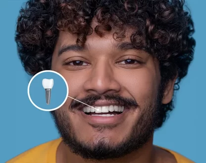 Missing-Teeth-Why-Dental-Implants-Are-the-Best-Solution